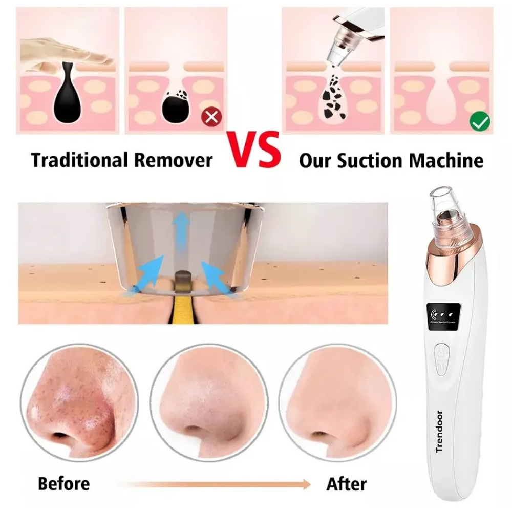 5-in-1 Rechargeable Pore Vacuum Cleaner with 5 Heads